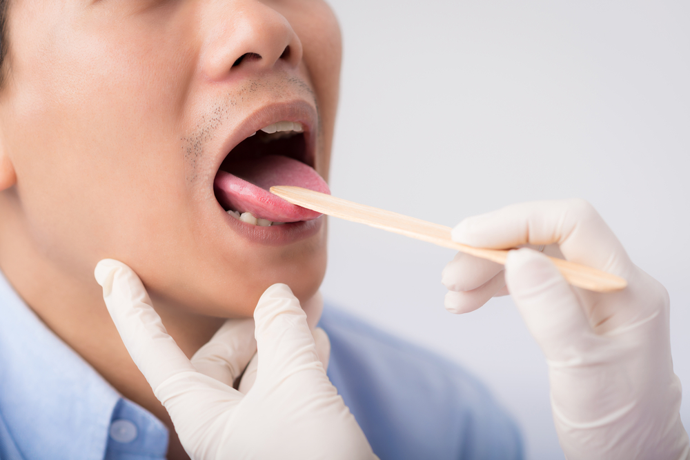 Predecir el riesgo de enfermedad a partir de 5 tipos de apariencia de su lengua
