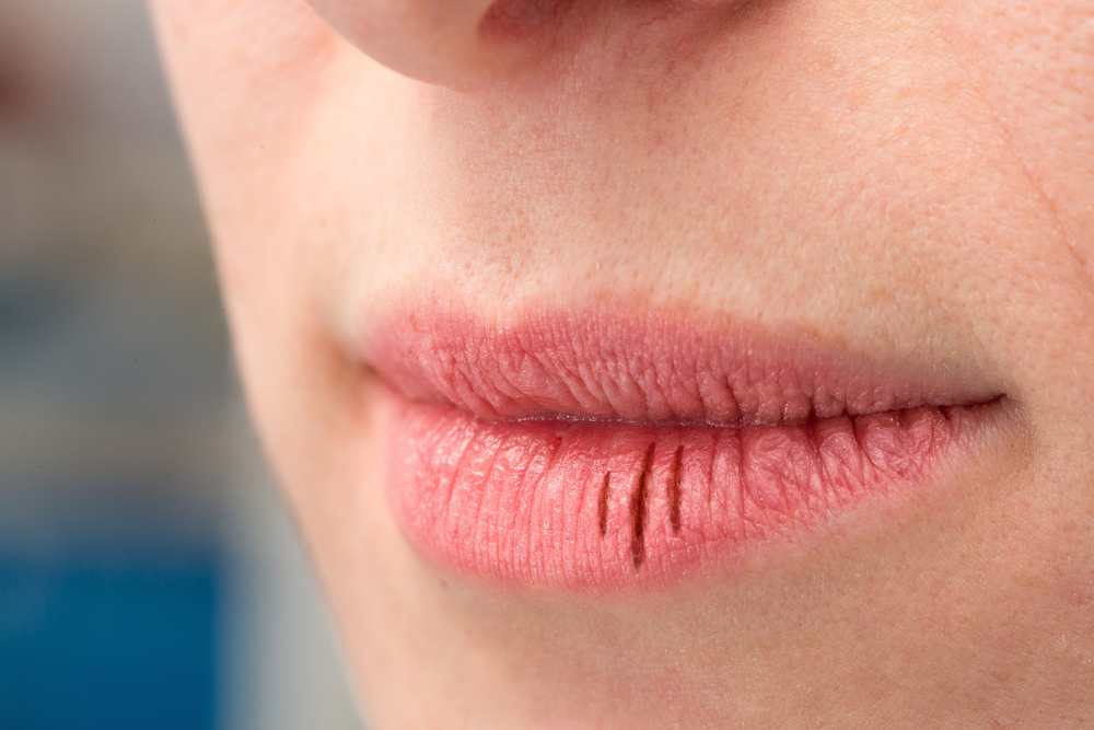 10 formas efectivas de superar los problemas de boca seca