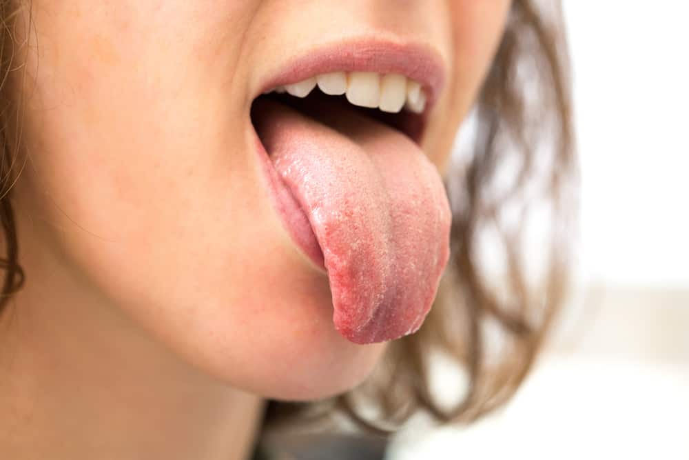 7 condiciones que hacen que le pique la lengua, desde problemas menores hasta problemas graves