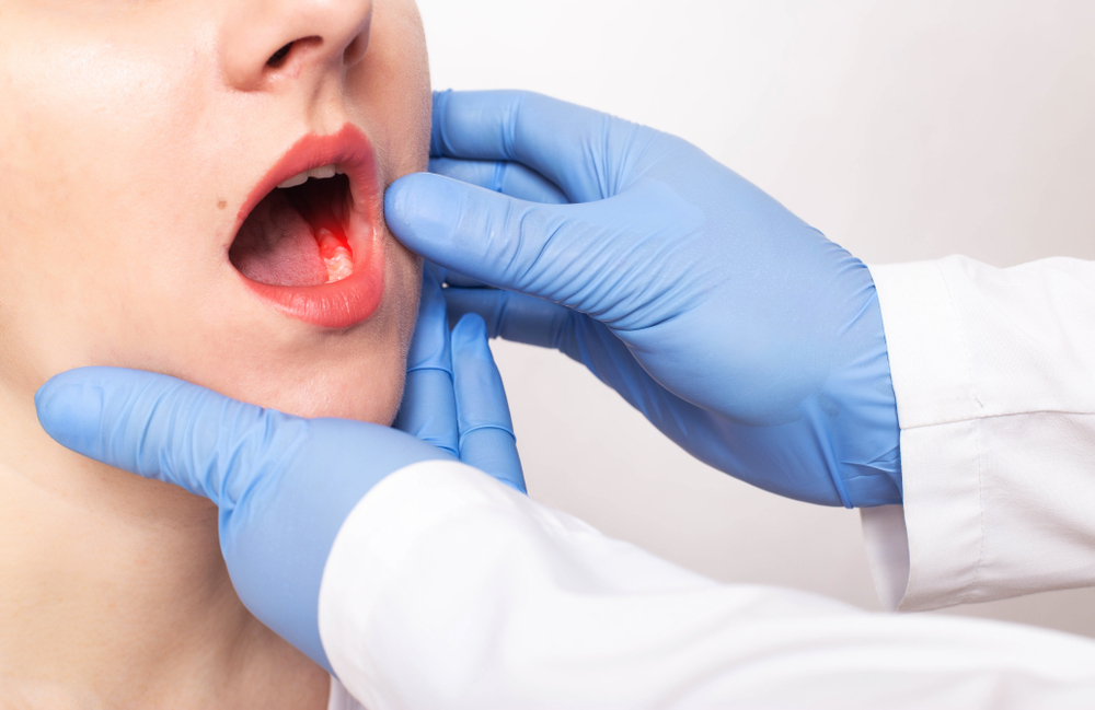 9 Optionen zur Behandlung von häufigem Zahnfleischbluten
