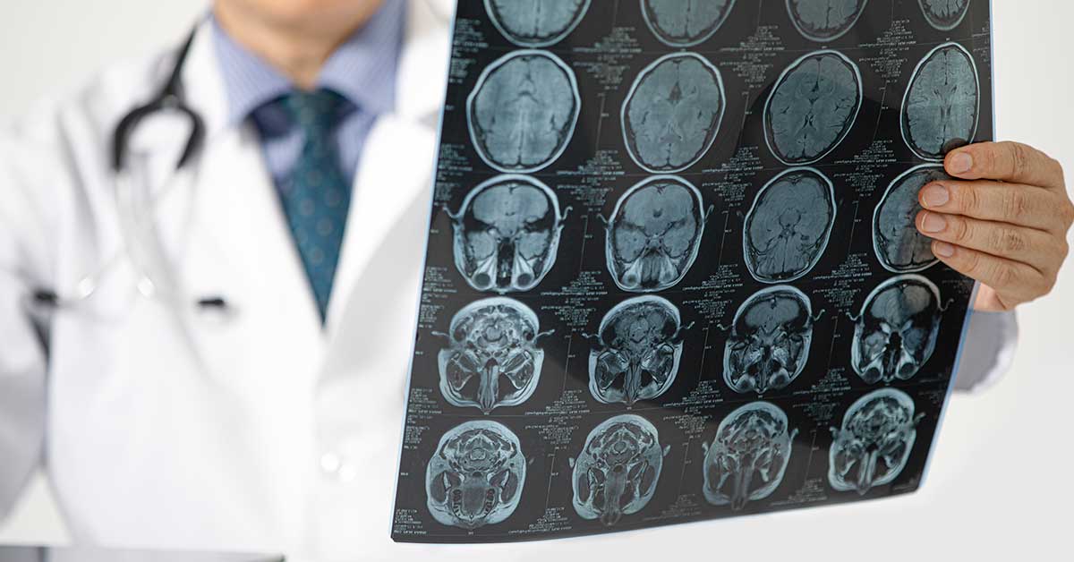 Različite vrste operacija za rak mozga i njihove nuspojave