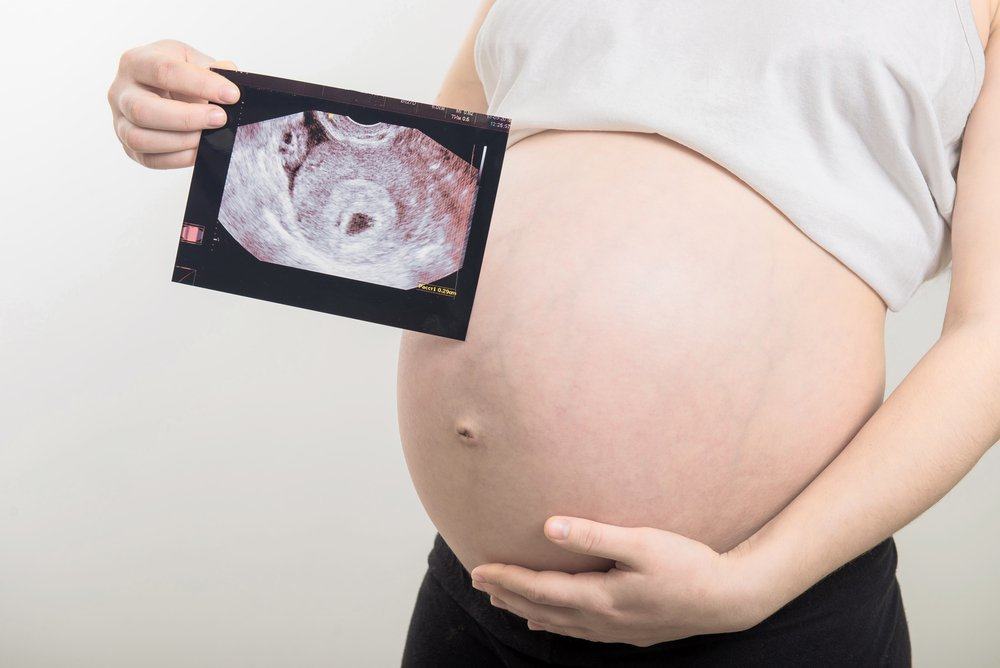 Ultraschall während der Schwangerschaft: Was tut es und ist es sicher?