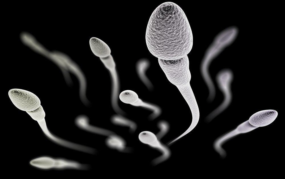 Verschiedene Spermienanomalien, die die Fruchtbarkeit beeinflussen
