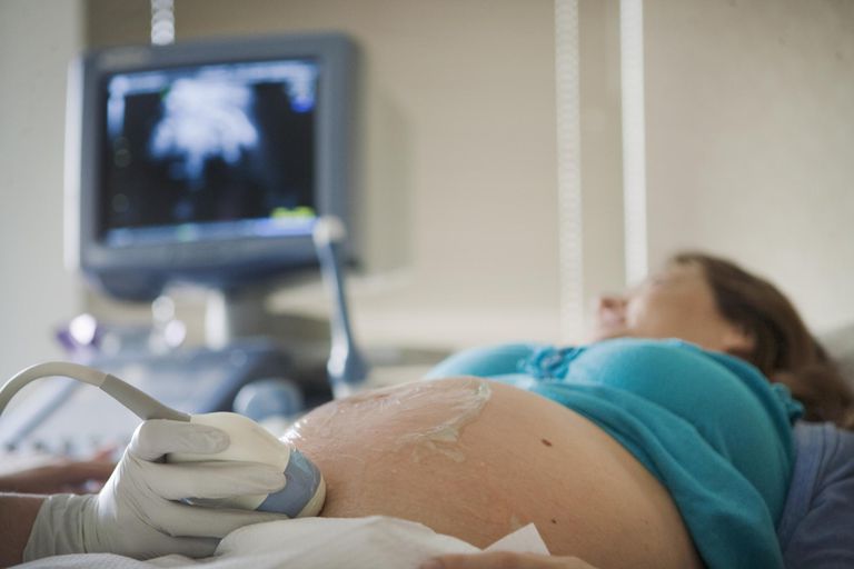 Conozca la prueba fetal sin estrés (NST), pruebas durante el embarazo para controlar la salud del bebé