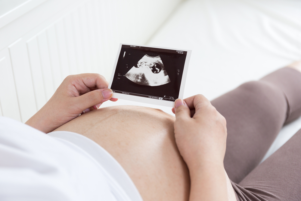 Можете ли вы родить нормально, если плод в утробе матери обвивается вокруг пуповины?