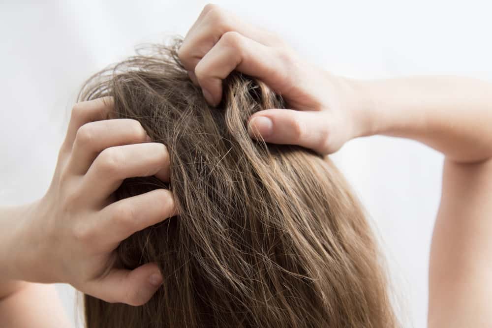 Consejos para superar la picazón en el cuero cabelludo según la causa