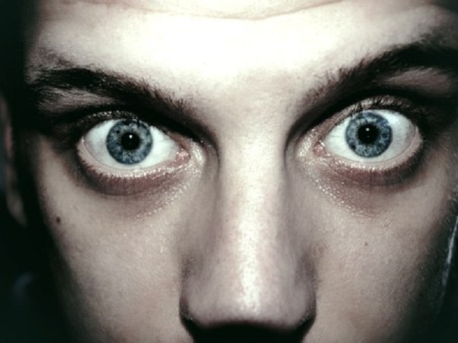 Die Augen stechen jedes Mal wie mit großen Augen hervor? Vorsicht vor Symptomen der Basedow-Krankheit