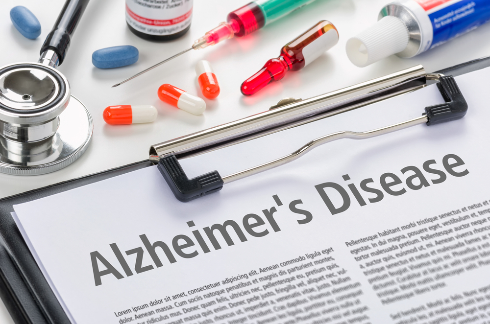 알츠하이머병을 치료하기 위한 약물 및 치료법을 알고 있습니다.