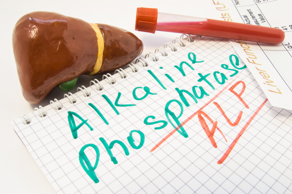 Was bedeutet es, wenn die Werte der alkalischen Phosphatase nach einem Bluttest hoch sind?