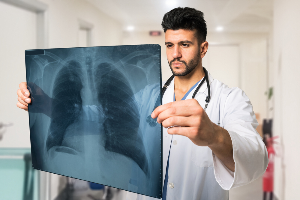 Varias complicaciones de la bronquitis de las que debe tener cuidado
