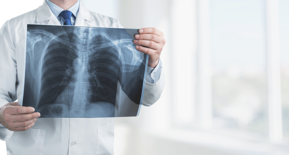 Lernen Sie Pneumokoniose, eine Atemwegserkrankung aus dem Arbeitsumfeld kennen