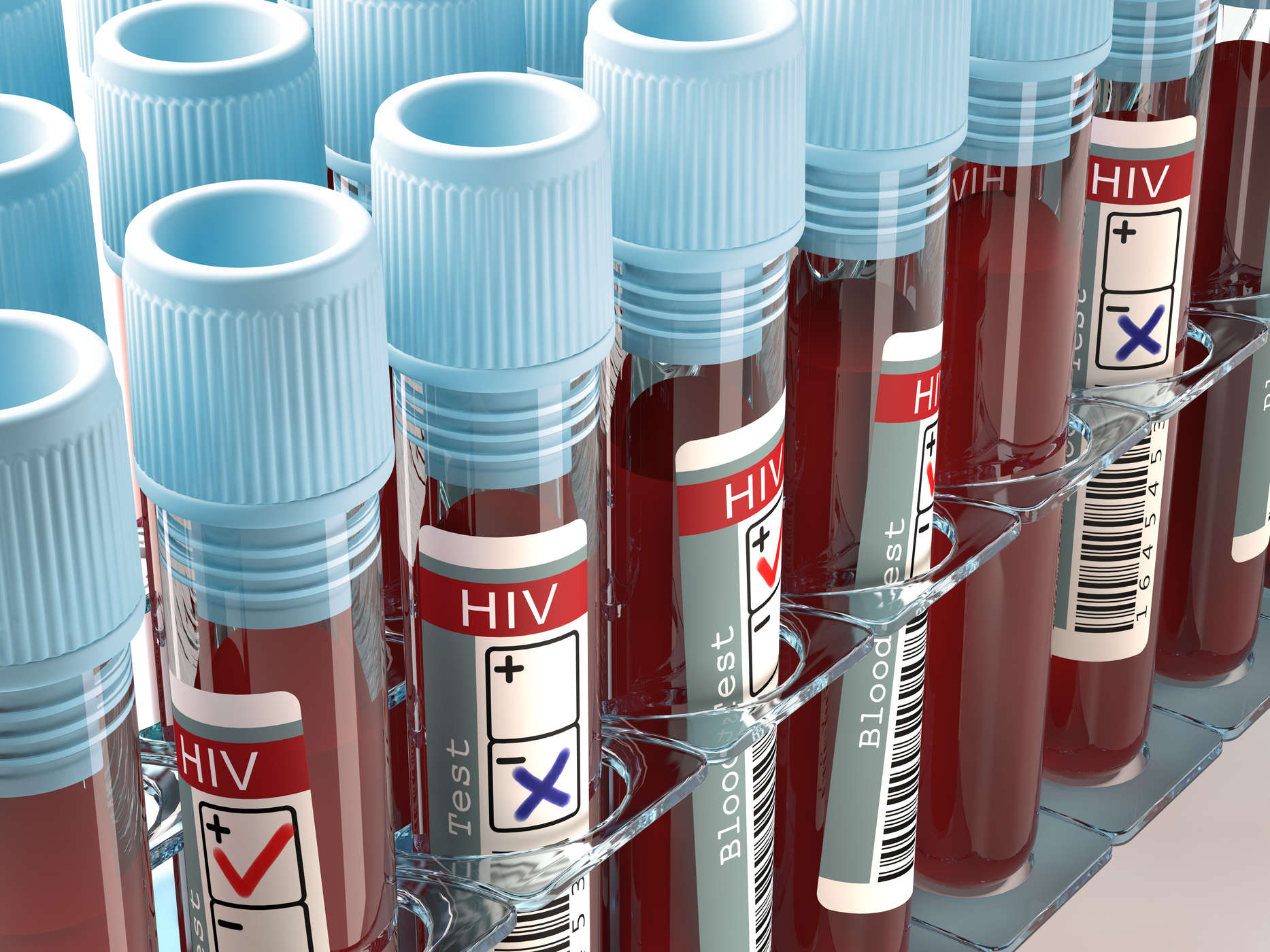 나는 HIV 감염의 위험이 있습니까? HIV AIDS의 다양한 원인을 조심하십시오