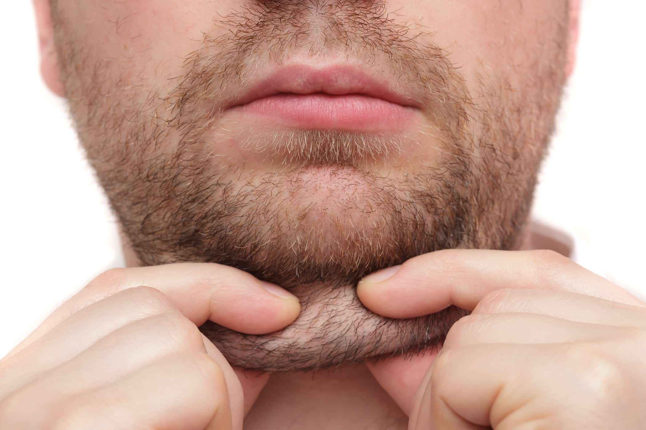 La grasa de la barbilla, ¿de dónde viene y cómo deshacerse de ella?