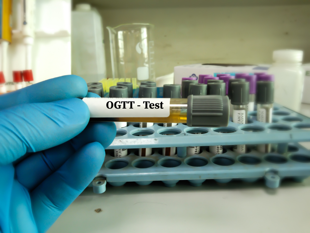 Oraler Glukosetoleranztest (OGTT) für die Diabetes-Diagnose